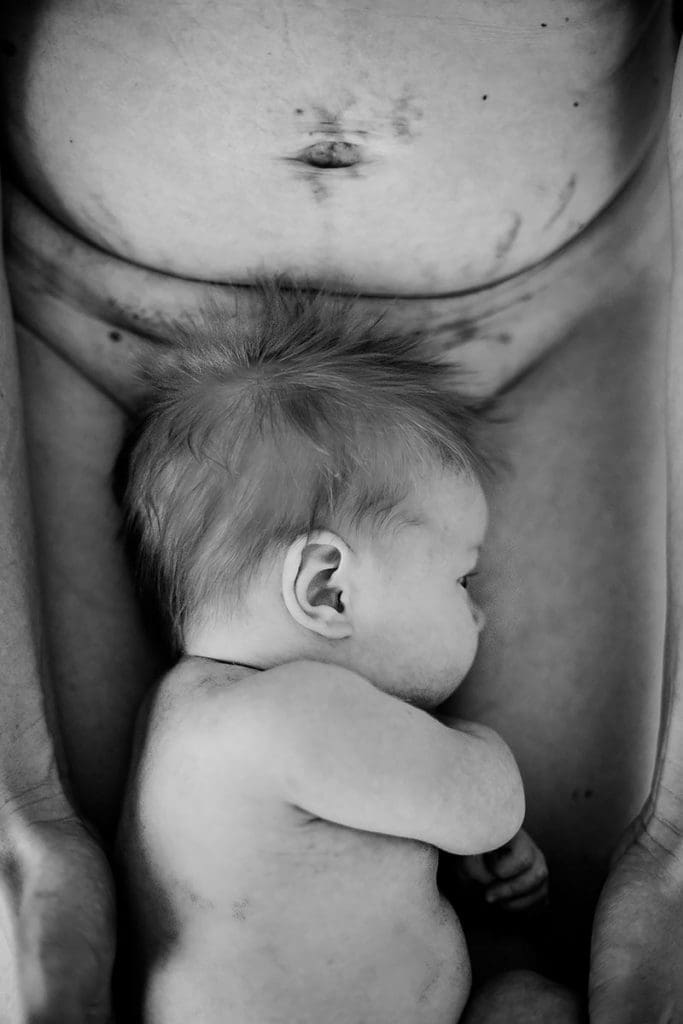 Caesarean Section 1 Credit: Debi Brett