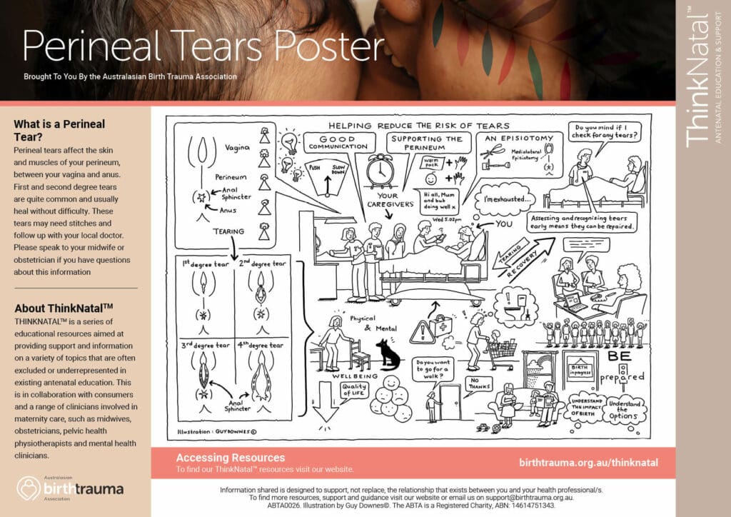 ABTA thinknatal posters - perineal tears