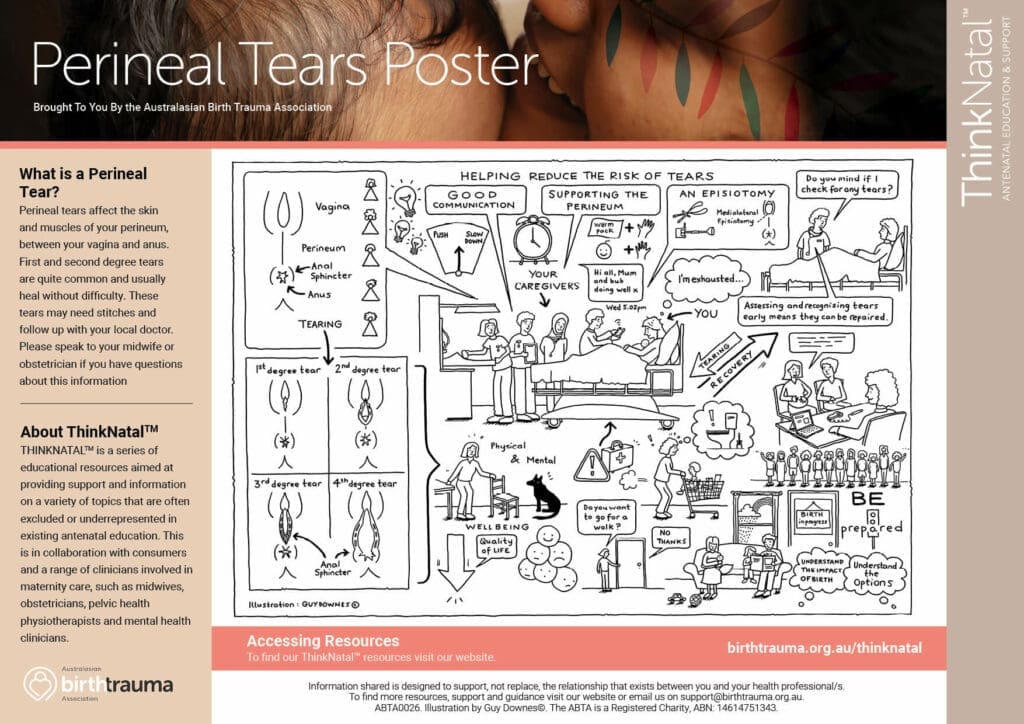 thinknatal 10 ABTA thinknatal posters - perineal tears