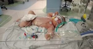 Baby Noa in NICU