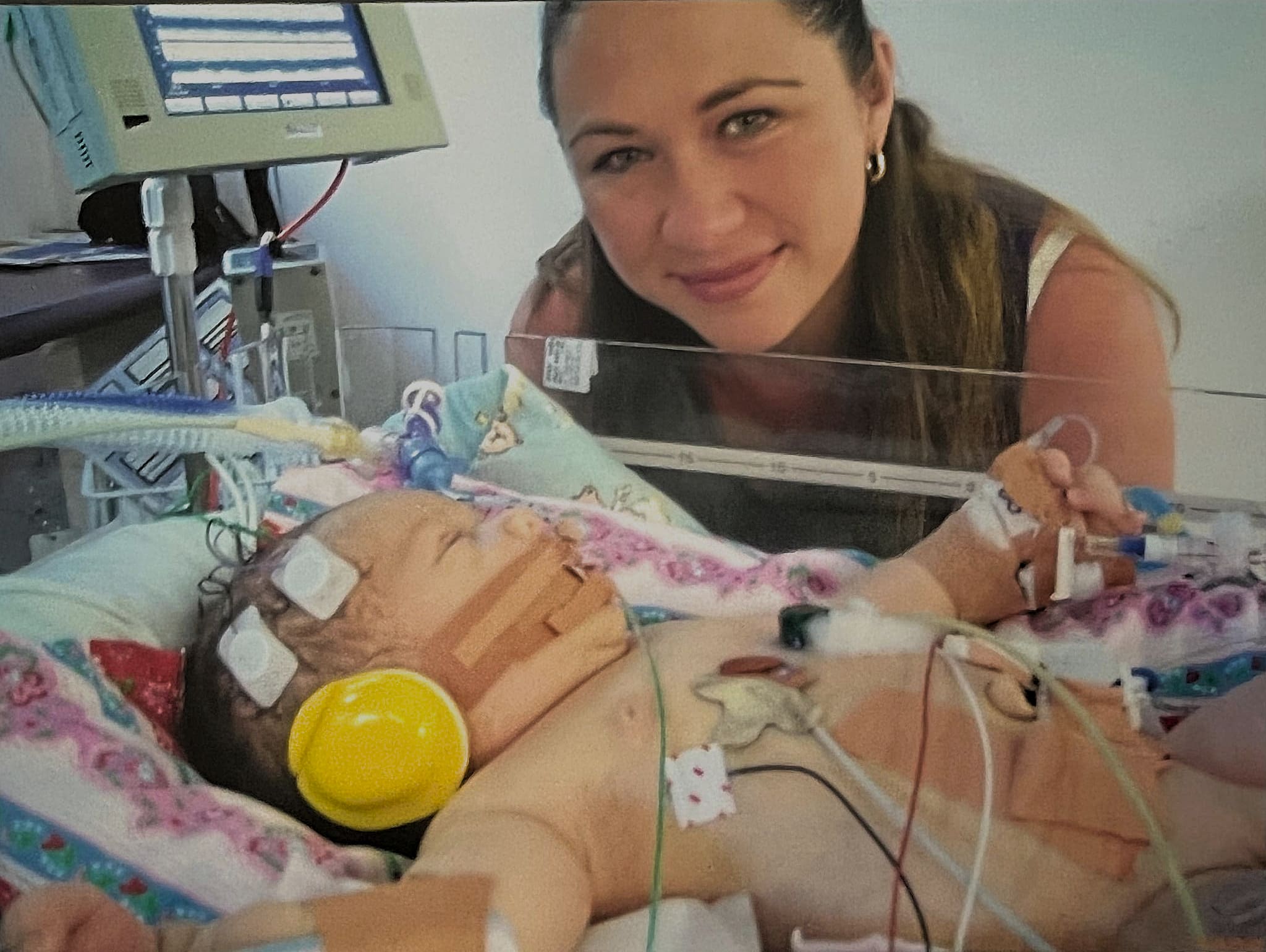 Baby Cody in NICU after birth trauma before his cerebral palsy diagnosis